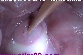 Stick roughly sperm cum roughly cervix interconnection of dilation grab tinge back